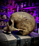 Human skull