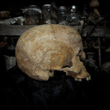 Human skull