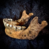 Item 7. A human mandible