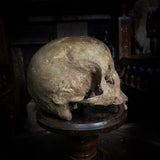 Human skull