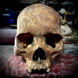 Human skull