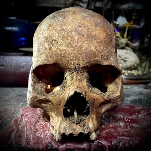 Human skull