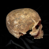 Item 20. Human skull