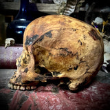 Human skull