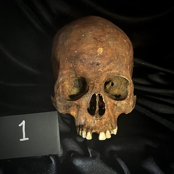Item 1. Human skull