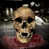 Human skull with mandible