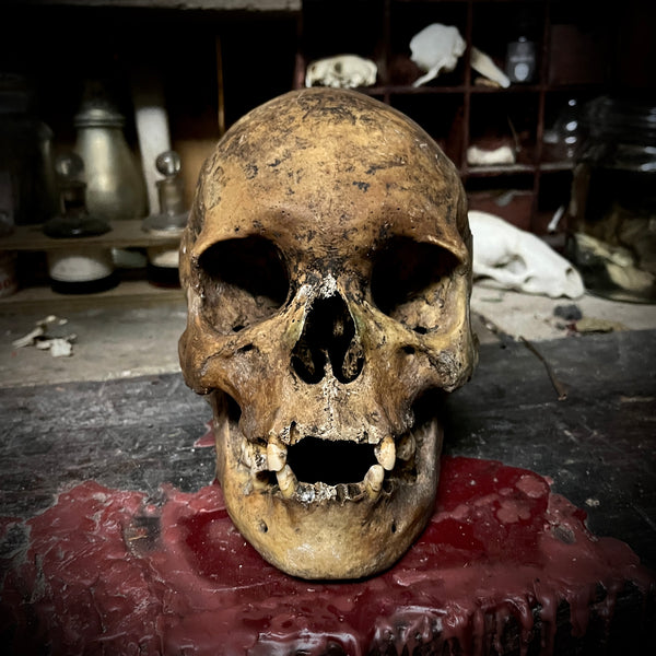 Human skull with mandible