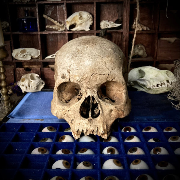 A human skull