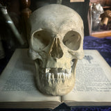 Medically prepared human skull