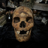 Human skull