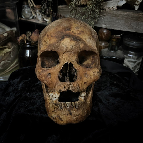 Human skull