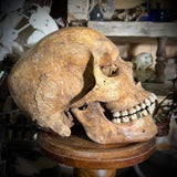 Human skull with mandible and brass teeth