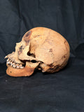 Item 15. Human skull with mandible