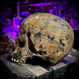 Human skull