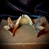Item 9. Human mandible