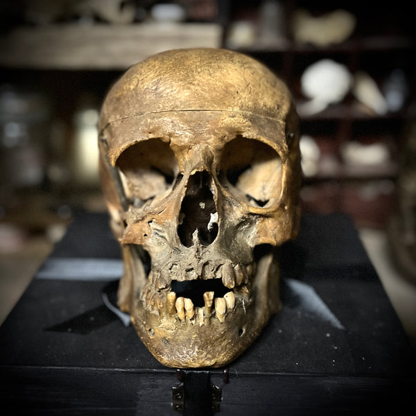Human medical skull