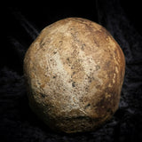 Human skull