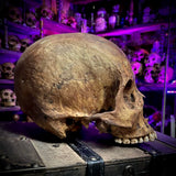 Human skull