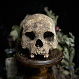 A human skull