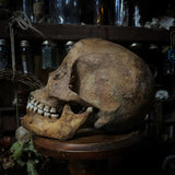 Human skull