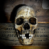 Human skull with mandible