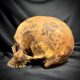 Item 11. Human skull