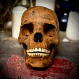 Human skull with mandible