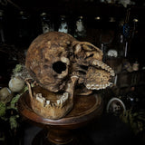 Human skull
