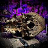 Human skull