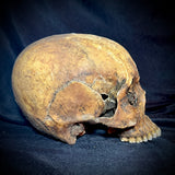 Item 9. Human skull