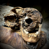 Human skull with mandible
