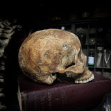 Human skull