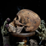 A human skull with mandible