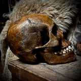 Human skull with mandible