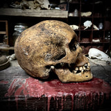 Human skull with mandible