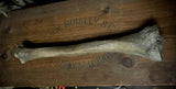Human tibia