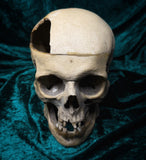 Medically prepared human skull