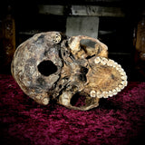 Human skull