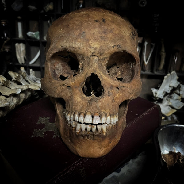 Human skull