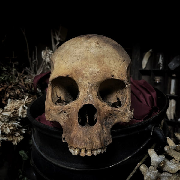 Human skull