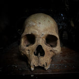 Human skull