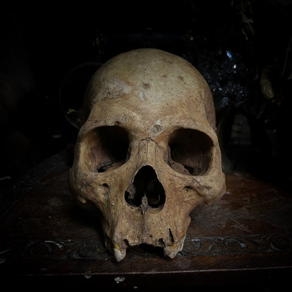 Human skull