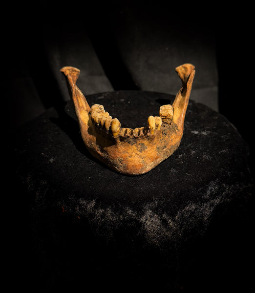 A mandible