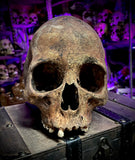 Human skull