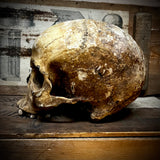 Human skull