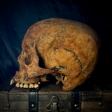 Item 3. Human skull