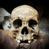 Human skull