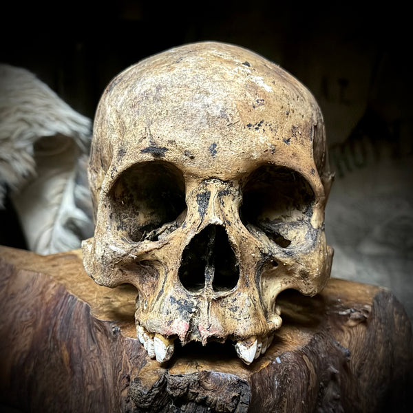 Human skull