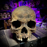 Human skull