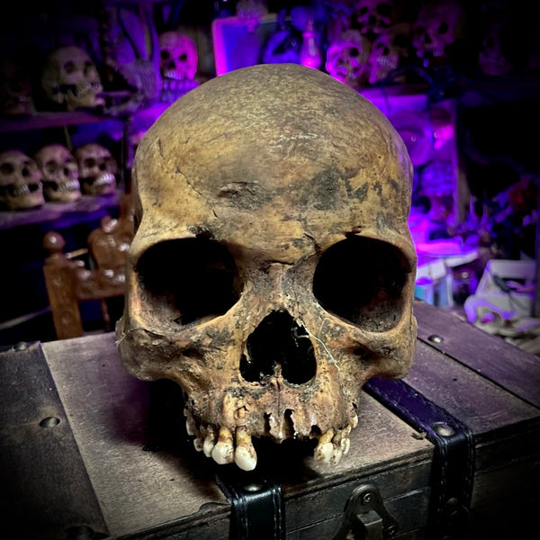 Human skull